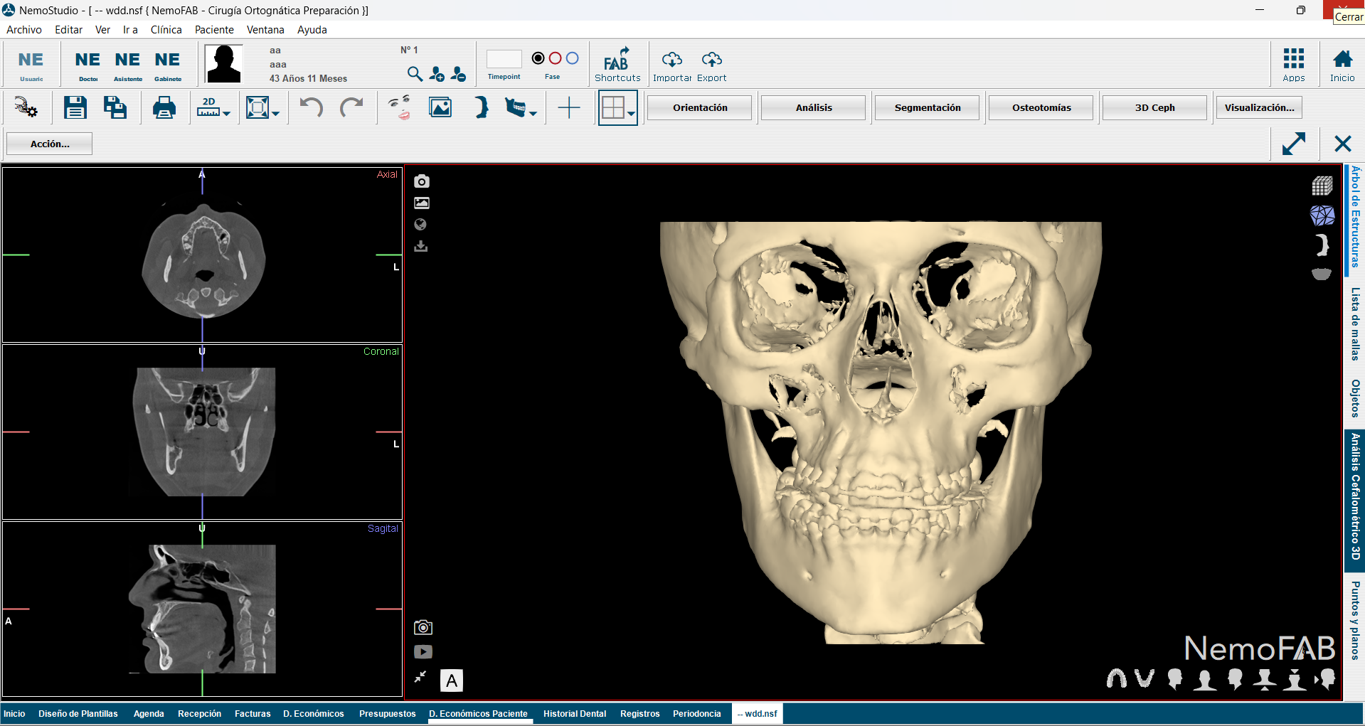 Programas par Maxilofaciales en NemoStudio 2024